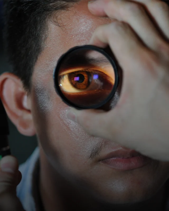 A photo of a man's eye, seen through a magnifying tool during a medical eye exam
