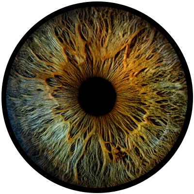 Close-up image of a blue-green iris with golden-brown details.